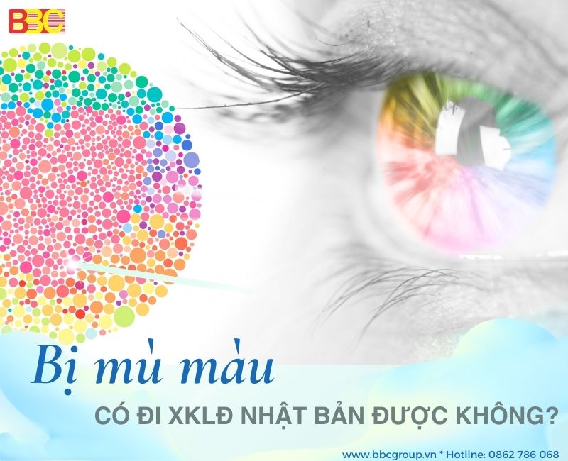 BỊ MÙ MÀU CÓ ĐI XKLĐ NHẬT BẢN ĐƯỢC KHÔNG?